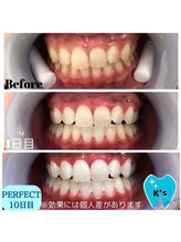 ケーズ(K's)/症例