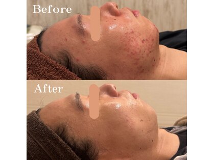 アンリミット 代々木上原店(Une limit)の写真