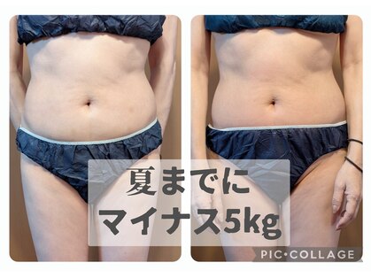 リリー(lily)の写真