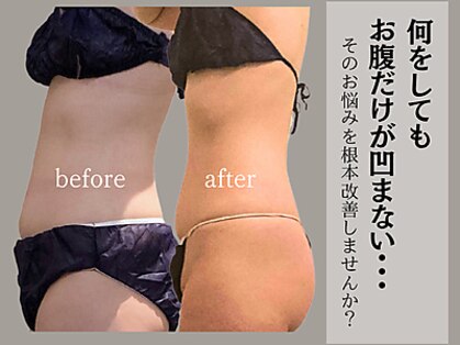 腸と頭の写真