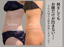 腸と頭