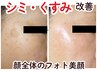 【シミ&くすみ】ハリ艶ある明るい肌へ☆顔全体のフォト美顔の広範囲ケア