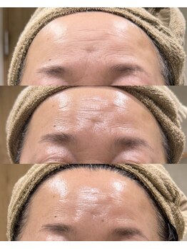 ソウ(SOW)の写真/【30代からの本気のエイジングケア】ハリ・弾力・引き締まった若々しい印象へ♪年齢に負けないお肌へ☆
