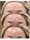 ソウ(SOW)の写真/【30代からの本気のエイジングケア】ハリ・弾力・引き締まった若々しい印象へ♪年齢に負けないお肌へ☆