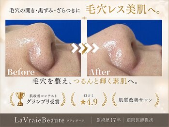 ラヴレボーテ(La Vraie Beaute)の写真/◆触れたくなるたまご肌へ♪毛穴レスを目指す根本改善!毛穴黒ずみ・毛穴開き・ざらつき毛穴お任せ下さい◆