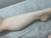 ナノハナ/鹿沼市全身脱毛美容室ナノハナ