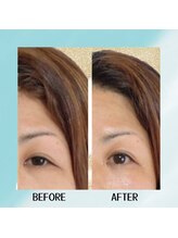 スーコ(SU:CO)/ビフォアフ　目！