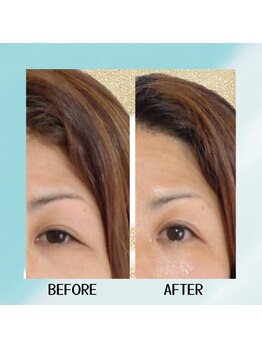 スーコ(SU:CO)/ビフォアフ　目！