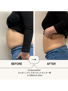 オーシャン整骨院(OCEAN整骨院)/ダイエット６ヶ月コース