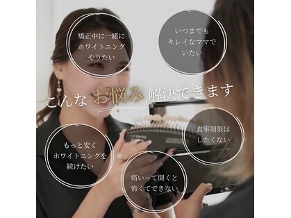 ホワイトニングショップ 宇都宮店の写真
