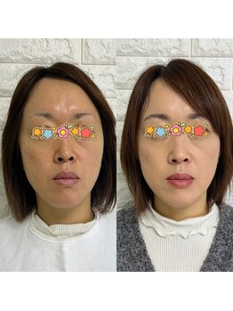 アマテラス(AMATERAS)/似合うリップ教授します♪♪