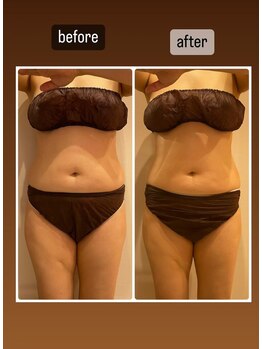 ララ(LALA)/痩身デトックスリンパマッサージ