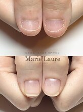 マリーロール 梅田店(Marie Laure)/深爪改善/自爪育成/ネイルケア