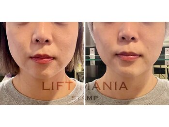 リリイ(Lily)/釧路希少！サーマルスタンプ♪