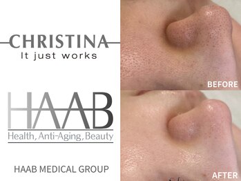 エテルナ(ETERNA)