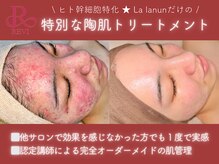 ラ ラナン(La lanun)