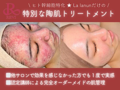 ラ ラナン(La lanun)の写真