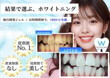 ホワイトニングショップ 新小岩店