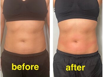 ブルースター(BLUE STAR)/オンダリフト【くびれ復活】