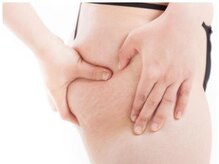 ソンリッサビエン(sonrisabien)/ セル脂肪を潰して流す！