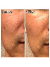 パーソナルエステティックサロン リボーン(ReBorn)/