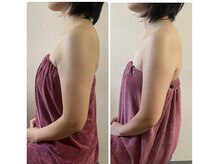 ブリランテ(Brillante)/体験→継続3回目のbeforeafter