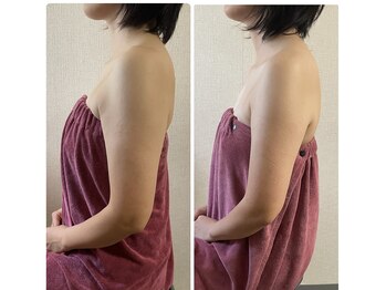 ブリランテ(Brillante)/体験→継続3回目のbeforeafter