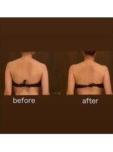 エミナル(EMINALu)/巻き肩・肩こり