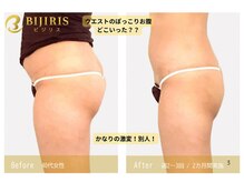 キングスサロン 熊本の雰囲気（新ダイエット効果！尿トラブル改善、下半身トレ多様な目的対応◎）