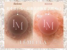 デミーナ(Demyna)の雰囲気（最新の色素沈着メラニンケア！一度でピンク◆乳輪の黒ずみなど◆）