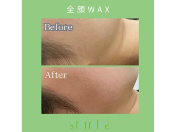 シンカ 湘南江ノ島 鵠沼(shinka)/【全顔WAX】