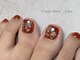 カルペ ディエム(Carpe diem)の写真/巻き爪にお悩みの方や爪の形にコンプレックスがある方など、ご相談ください♪指先を美しく導きます！