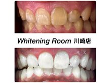 ホワイトニングルーム 川崎店(WhiteningRoom)