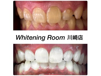 ホワイトニングルーム 川崎店(WhiteningRoom)