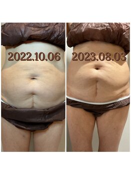 シストワ(sistoi)/お腹ケア★WINBACK