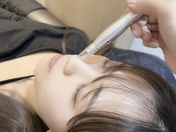 ノエルトット 二子玉川(Noel totto)の写真/<二子玉川で希少なアイ×毛穴洗浄>話題の毛穴洗浄を優しい価格で提供!目元/顔周りをトータルプロデュース★