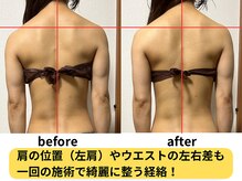 シェノンミュリール(Chainon Murir)