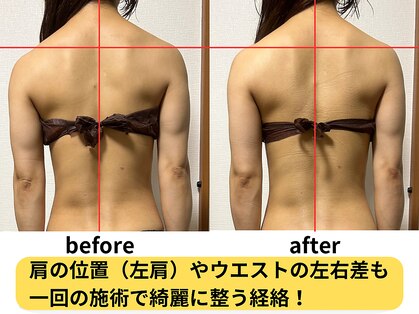 シェノンミュリール(Chainon Murir)の写真
