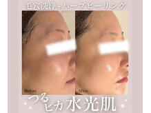 アトランティカ(ATLANTICA)/