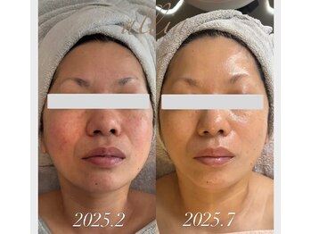 アリア(allia)/クリスティーナトリートメント