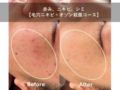 ヴィベル(vi Belle)の写真