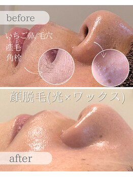プアマヌ(PUA MANU)/鼻の毛穴