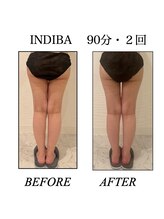 ファミーユ 新宿店/【インディバビフォーアフター】