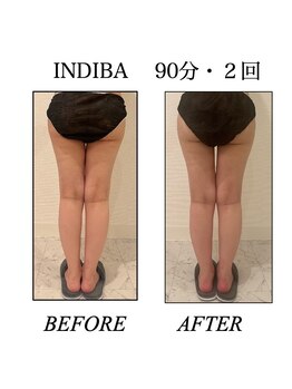 ファミーユ 新宿店/【インディバビフォーアフター】