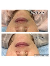 レイモード(Ray mode)/BBLフェイシャル＆パック