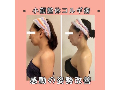 小顔フェイスラボ 浜松店(小顔FaceLabo.)の写真