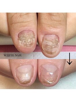 ホワイトネイル 武蔵小杉店(WHITE NAIL)/ネイルケア・自爪育成・爪育