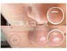 (2回目～)【毛穴美人コース】長年のお悩み毛穴に！（黒ずみ、ザラつき）
