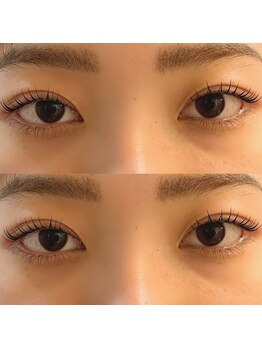 ユーロ(EURO)/ラッシュリフト