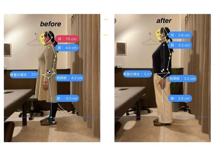 ユッカ(Yucca)の写真